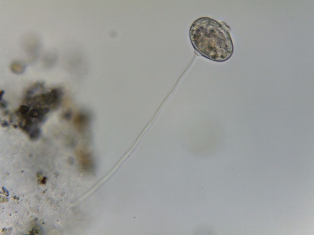 Vorticella sp. (riproduzione asessuata)